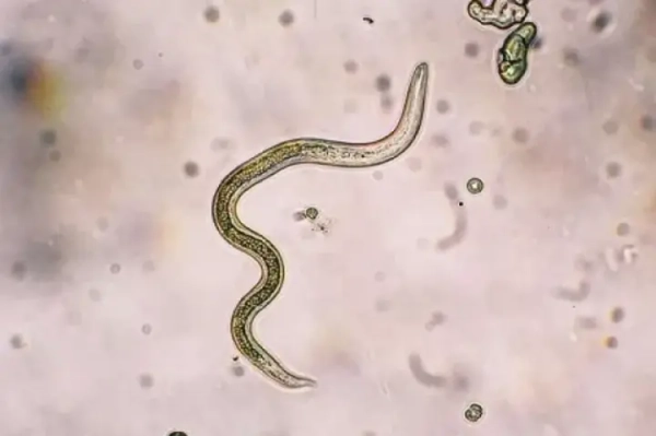 WHO Caution: Schistosomiasis “Mixed Strain” Worms Threaten Global&hellip;